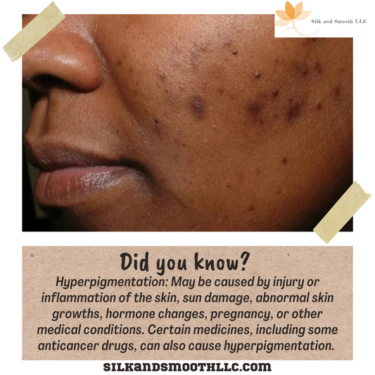 How to Fade Dark Spots Naturally (And What Actually Works)